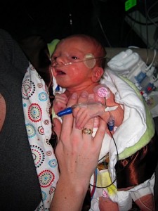 Grair after breathing tube